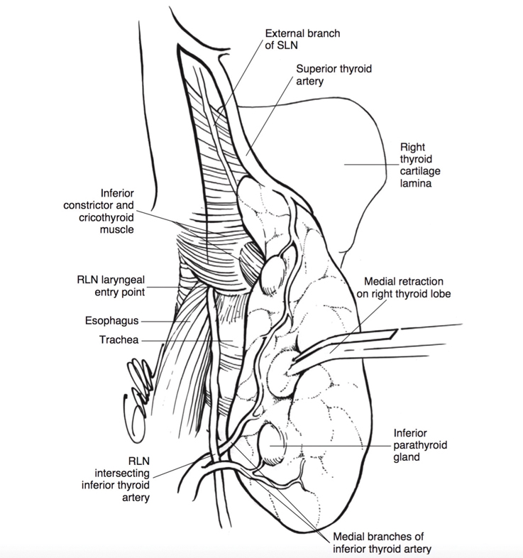 thyroid surgery